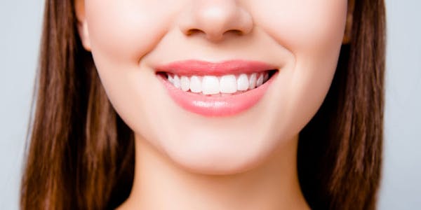 Dental Fillings Surrey